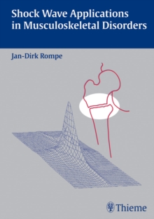 Shock Wave Applications in Musculoskeletal Disorders