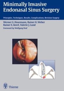 Minimally Invasive Endonasal Sinus Surgery : Principles, Techniques, Results, Complications, Revision Surgery