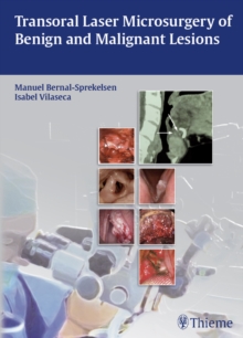 Transoral Laser Microsurgery of Benign and Malignant Lesions