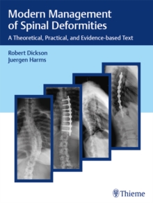 Modern Management of Spinal Deformities : A Theoretical, Practical, and Evidence-Based Text