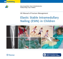 Elastic Stable Intramedullary Nailing (ESIN) in Children