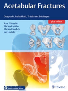 Acetabular Fractures : Diagnosis, Indications, Treatment Strategies