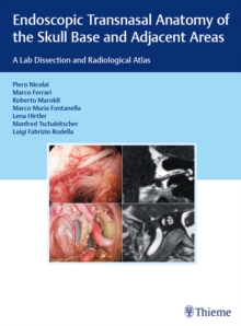 Endoscopic Transnasal Anatomy of the Skull Base and Adjacent Areas : A Lab Dissection and Radiological Atlas