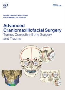 Advanced Craniomaxillofacial Surgery : Tumor, Corrective Bone Surgery, and Trauma