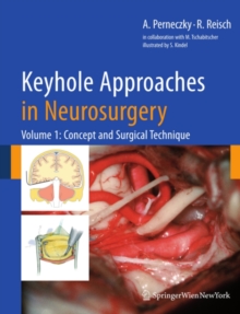 Keyhole Approaches in Neurosurgery : Volume 1: Concept and Surgical Technique