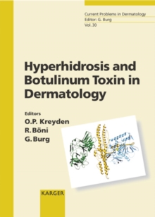 Hyperhidrosis and Botulinum Toxin in Dermatology