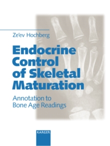 Endocrine Control of Skeletal Maturation : Annotation to Bone Age Readings.