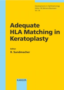 Adequate HLA Matching in Keratoplasty