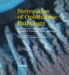 Stereoatlas of Ophthalmic Pathology : Anatomy and Pathology of the Peripheral Fundus (Fundus extremus) A bequest of Basil Daicker, former Professor of Ophthalmic Pathology in Basel Includes stereo gla