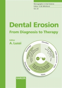 Dental Erosion : From Diagnosis to Therapy.