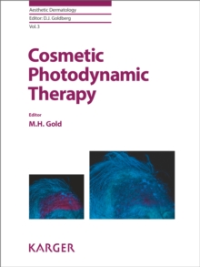 Cosmetic Photodynamic Therapy