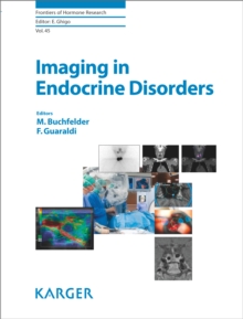 Imaging in Endocrine Disorders