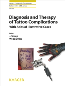 Diagnosis and Therapy of Tattoo Complications : With Atlas of Illustrative Cases.