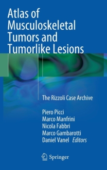 Atlas of Musculoskeletal Tumors and Tumorlike Lesions : The Rizzoli Case Archive, Hardback Book Atlas of Musculoskeletal Tumors and Tumorlike Lesions : The Rizzoli Case Archive, Hardback Book
