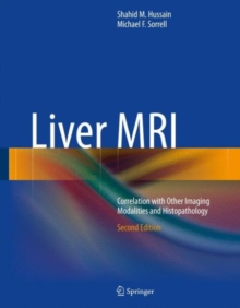 Liver MRI : Correlation with Other Imaging Modalities and Histopathology, Hardback Book Liver MRI : Correlation with Other Imaging Modalities and Histopathology, Hardback Book
