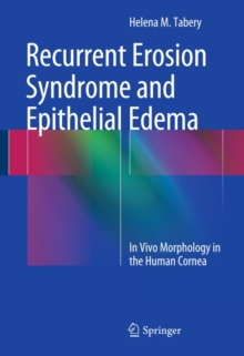 Recurrent Erosion Syndrome and Epithelial Edema : In Vivo Morphology in the Human Cornea