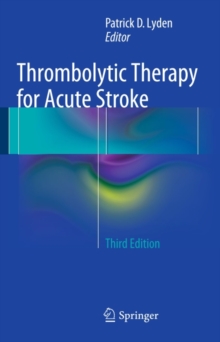 Thrombolytic Therapy for Acute Stroke