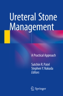 Ureteral Stone Management : A Practical Approach