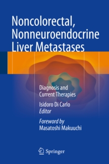 Noncolorectal, Nonneuroendocrine Liver Metastases : Diagnosis and Current Therapies