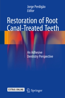 Restoration of Root Canal-Treated Teeth : An Adhesive Dentistry Perspective