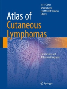Atlas of Cutaneous Lymphomas : Classification and Differential Diagnosis, Hardback Book Atlas of Cutaneous Lymphomas : Classification and Differential Diagnosis, Hardback Book