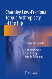 Charnley Low-Frictional Torque Arthroplasty of the Hip : Practice and Results