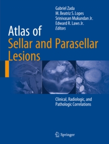 Atlas of Sellar and Parasellar Lesions : Clinical, Radiologic, and Pathologic Correlations