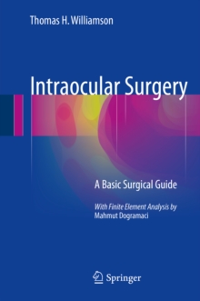 Intraocular Surgery : A Basic Surgical Guide