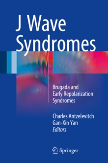 J Wave Syndromes : Brugada and Early Repolarization Syndromes