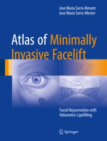 Atlas of Minimally Invasive Facelift : Facial Rejuvenation with Volumetric Lipofilling