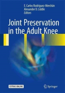 Joint Preservation in the Adult Knee, Hardback Book Joint Preservation in the Adult Knee, Hardback Book