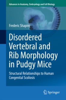 Disordered Vertebral and Rib Morphology in Pudgy Mice : Structural Relationships to Human Congenital Scoliosis