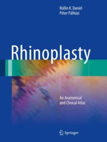 Rhinoplasty : An Anatomical and Clinical Atlas