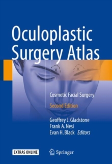 Oculoplastic Surgery Atlas : Cosmetic Facial Surgery, Hardback Book Oculoplastic Surgery Atlas : Cosmetic Facial Surgery, Hardback Book