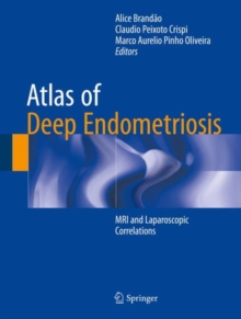 Atlas of Deep Endometriosis : MRI and Laparoscopic Correlations, Hardback Book Atlas of Deep Endometriosis : MRI and Laparoscopic Correlations, Hardback Book