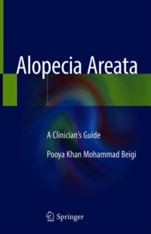 Alopecia Areata : A Clinician's Guide, Hardback Book Alopecia Areata : A Clinician's Guide, Hardback Book