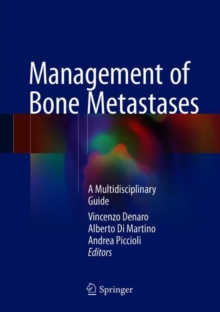 Management of Bone Metastases : A Multidisciplinary Guide