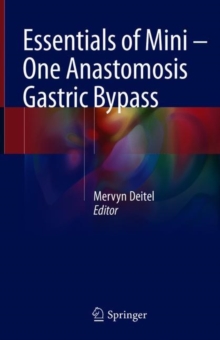 Essentials of Mini - One Anastomosis Gastric Bypass, Hardback Book Essentials of Mini - One Anastomosis Gastric Bypass, Hardback Book