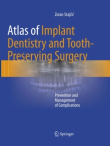 Atlas of Implant Dentistry and Tooth-Preserving Surgery : Prevention and Management of Complications
