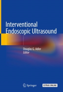 Interventional Endoscopic Ultrasound