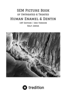 SEM Picture Book of Untreated & Treated Human Enamel & Dentin : High Resolution Scanning Electron Microscopic Pictures of Human Enamel & Dentin