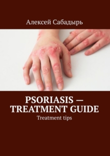 Psoriasis - treatment guide