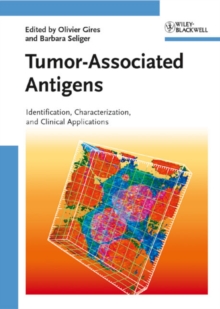 Tumor-Associated Antigens : Identification, Characterization, and Clinical Applications