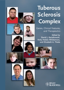 Tuberous Sclerosis Complex : Genes, Clinical Features and Therapeutics