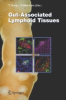 Gut-Associated Lymphoid Tissues