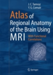 Atlas of Regional Anatomy of the Brain Using MRI : With Functional Correlations