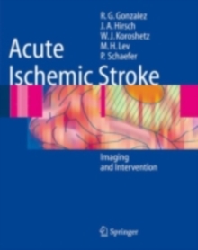 Acute Ischemic Stroke : Imaging and Intervention