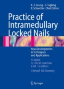 Practice of Intramedullary Locked Nails : New Developments in Techniques and Applications