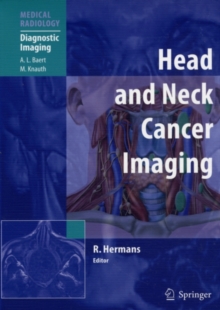 Head and Neck Cancer Imaging