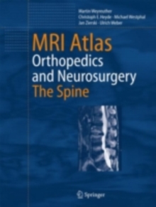 MRI Atlas : Orthopedics and Neurosurgery, The Spine